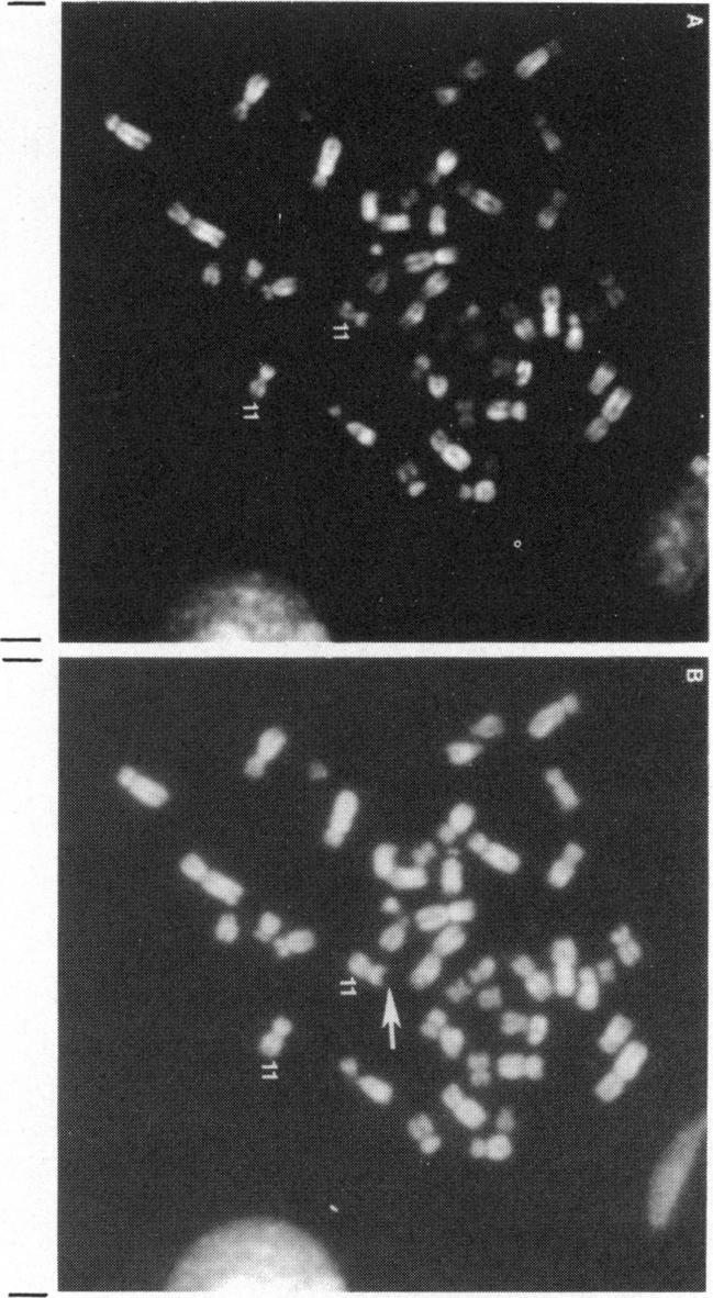 https://cdn.ncbi.nlm.nih.gov/pmc/blobs/0cf6/1684456/d1dbb2eb5476/ajhg00165-0087-a.jpg