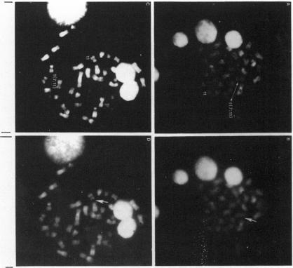 https://cdn.ncbi.nlm.nih.gov/pmc/blobs/0cf6/1684456/f80903a3abfe/ajhg00165-0089-a.jpg