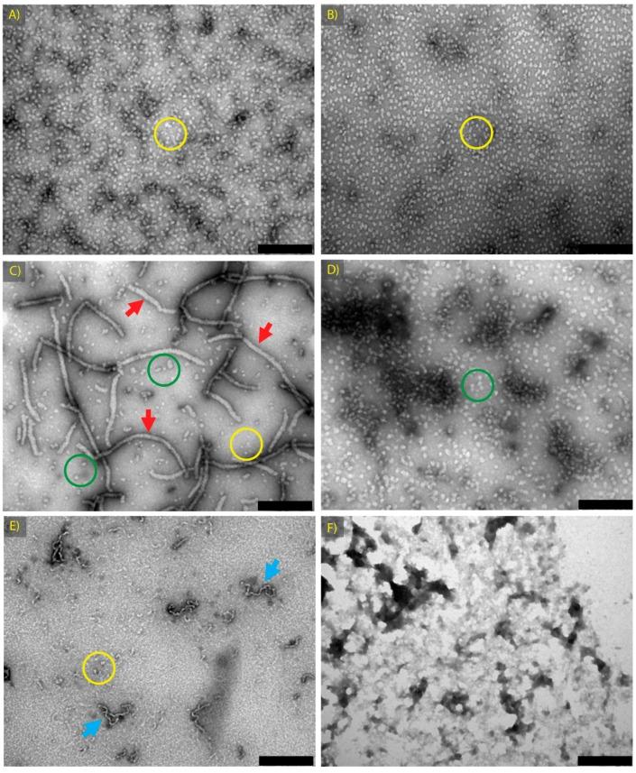 https://cdn.ncbi.nlm.nih.gov/pmc/blobs/0cfd/5618248/2dfe648af201/biomolecules-07-00067-g002.jpg