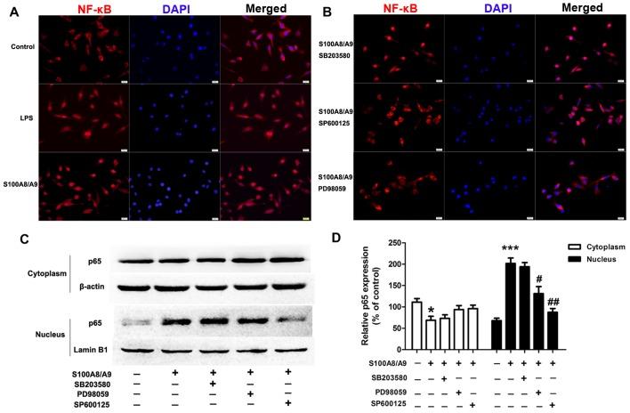 https://cdn.ncbi.nlm.nih.gov/pmc/blobs/0d01/5466387/b9aca2f5d636/IJMM-40-01-0031-g04.jpg