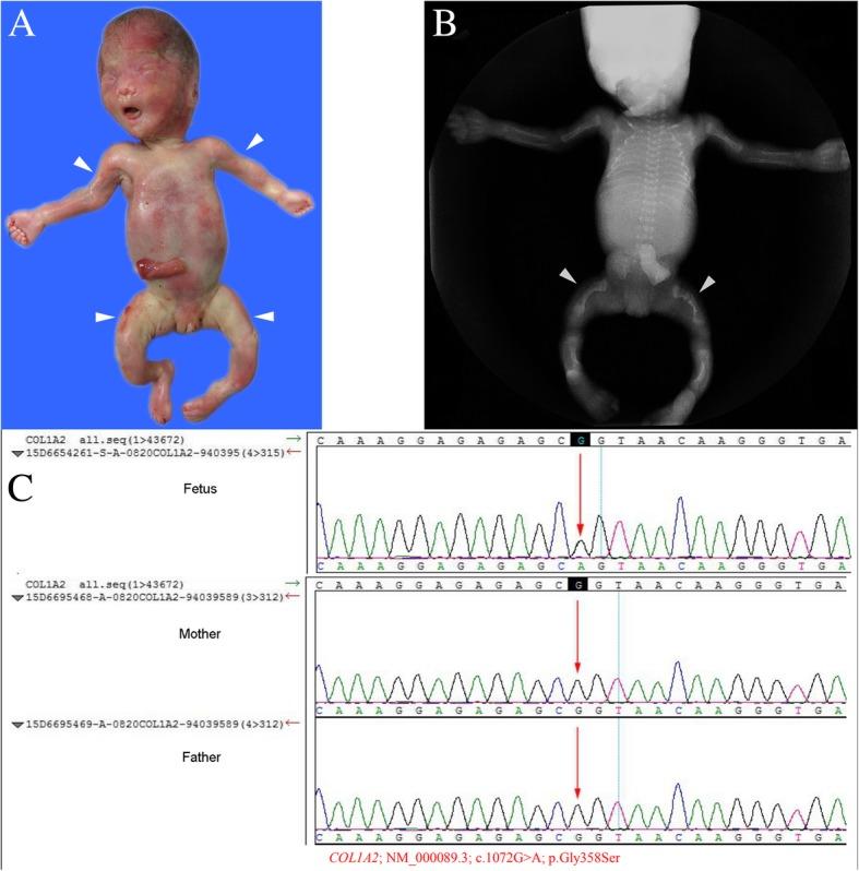 https://cdn.ncbi.nlm.nih.gov/pmc/blobs/0d12/6626426/56006fad8f61/13000_2019_853_Fig2_HTML.jpg