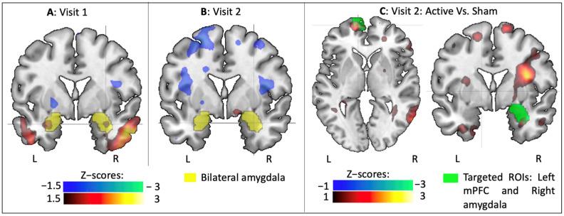 https://cdn.ncbi.nlm.nih.gov/pmc/blobs/0d15/8070235/70512d46001d/brainsci-11-00494-g004.jpg