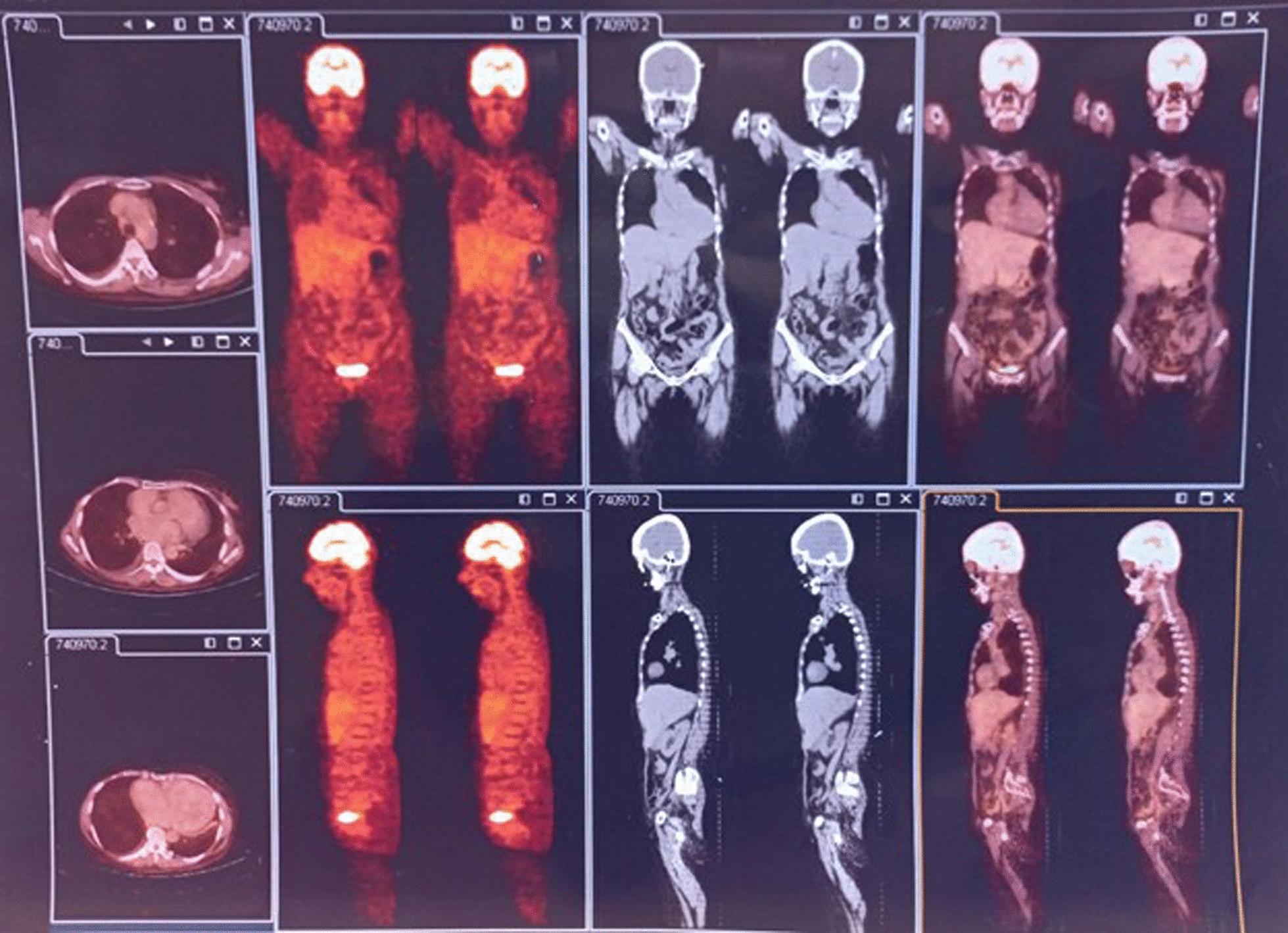 https://cdn.ncbi.nlm.nih.gov/pmc/blobs/0d1a/11373447/415031fc9018/13256_2024_4734_Fig1_HTML.jpg
