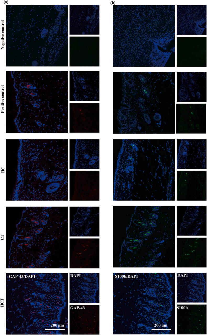 https://cdn.ncbi.nlm.nih.gov/pmc/blobs/0d1b/11629240/19349ff2cb93/gr11.jpg