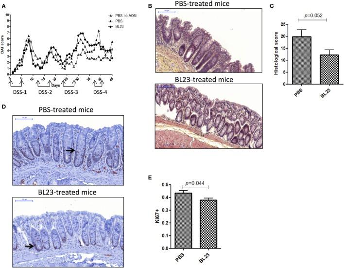 https://cdn.ncbi.nlm.nih.gov/pmc/blobs/0d1c/5702231/17e2ac1f2413/fimmu-08-01553-g003.jpg