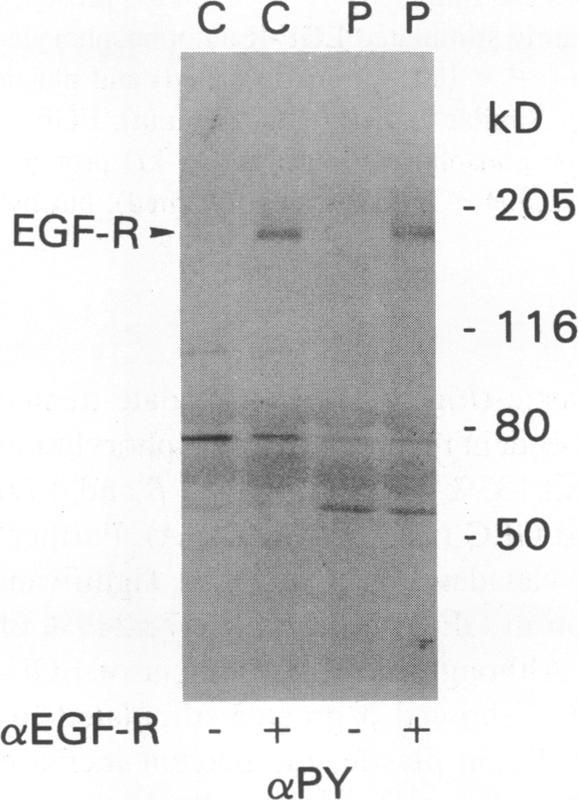 https://cdn.ncbi.nlm.nih.gov/pmc/blobs/0d1d/296283/098ddac35263/jcinvest00019-0090-b.jpg