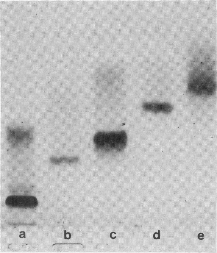 https://cdn.ncbi.nlm.nih.gov/pmc/blobs/0d2f/2041058/20e34bf0c8ea/brjexppathol00087-0029-a.jpg