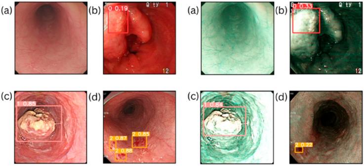 https://cdn.ncbi.nlm.nih.gov/pmc/blobs/0d34/12248576/97de2f32dab7/diagnostics-15-01686-g002.jpg
