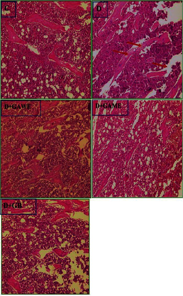 https://cdn.ncbi.nlm.nih.gov/pmc/blobs/0d35/9448544/0187a9552c37/ECAM2022-6816942.008.jpg
