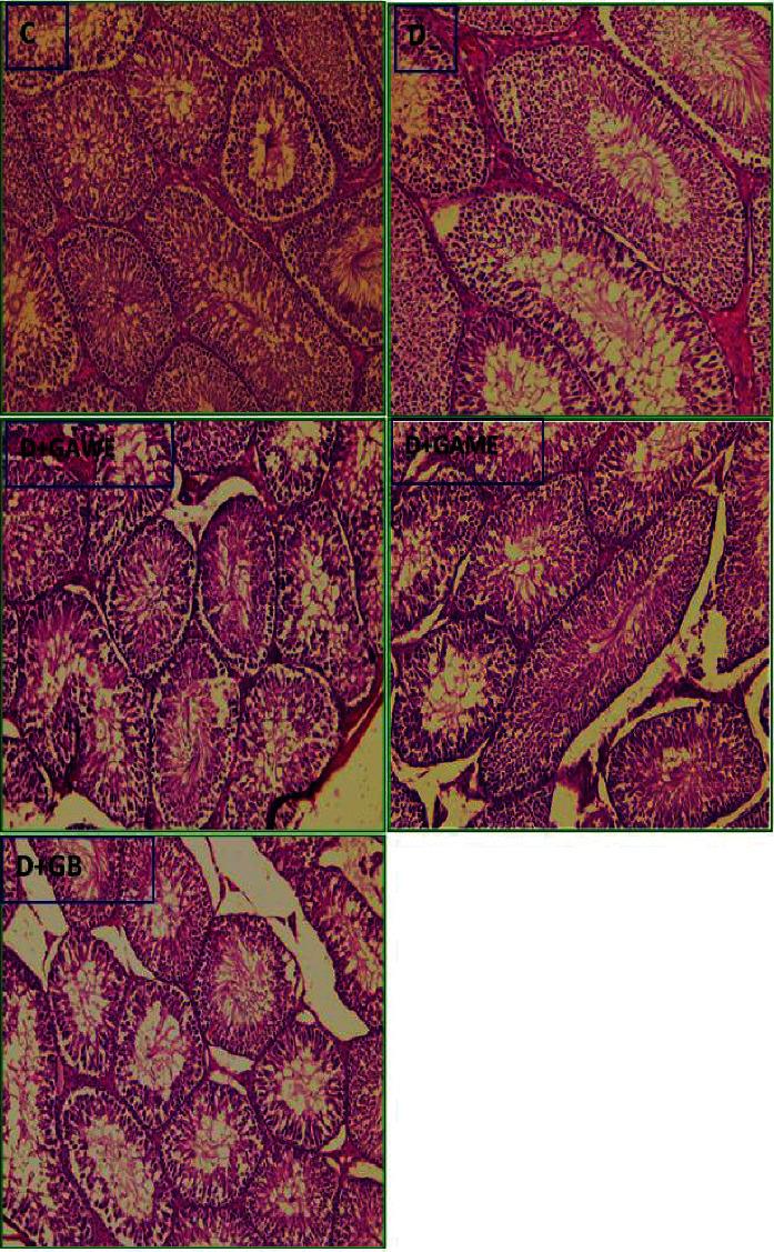https://cdn.ncbi.nlm.nih.gov/pmc/blobs/0d35/9448544/326ced16c9b4/ECAM2022-6816942.006.jpg