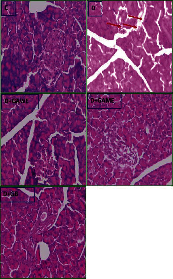 https://cdn.ncbi.nlm.nih.gov/pmc/blobs/0d35/9448544/d242294bb915/ECAM2022-6816942.002.jpg
