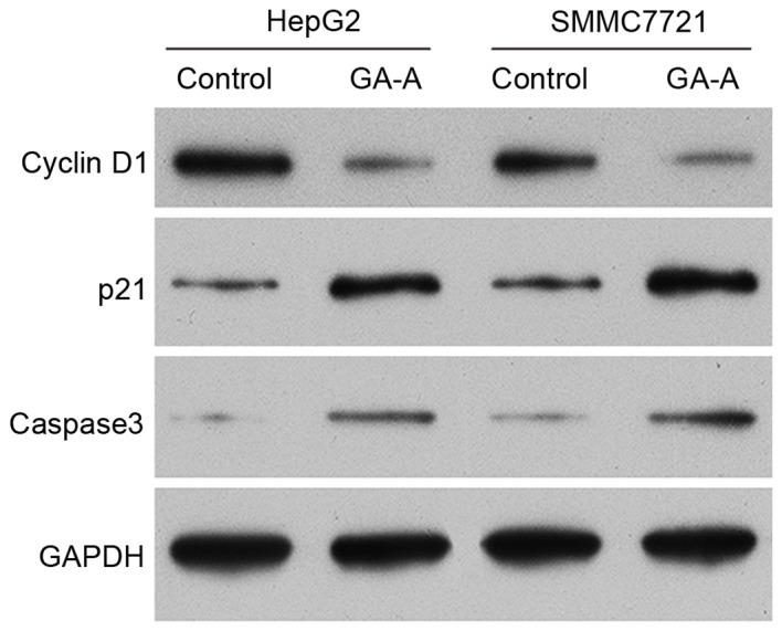 https://cdn.ncbi.nlm.nih.gov/pmc/blobs/0d37/5646967/97b1251bfe5b/MMR-16-04-3894-g03.jpg