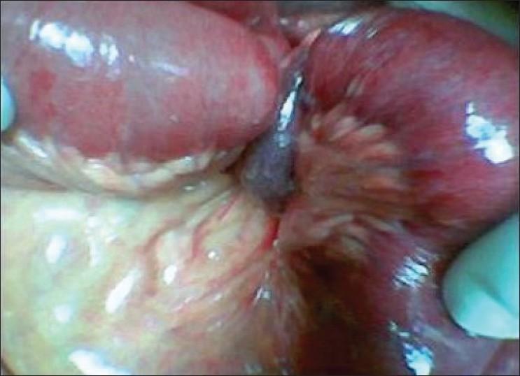 https://cdn.ncbi.nlm.nih.gov/pmc/blobs/0d3b/3178930/6a69ef75d617/SJG-17-368-g001.jpg