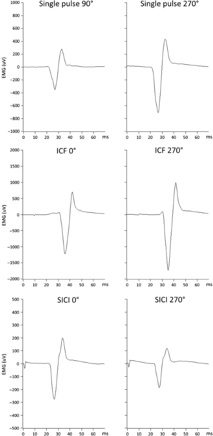 https://cdn.ncbi.nlm.nih.gov/pmc/blobs/0d3f/5028010/d1f06515cf06/bhw245f05.jpg