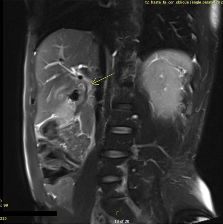 https://cdn.ncbi.nlm.nih.gov/pmc/blobs/0d40/11152821/05f40e082b96/ms9-86-3646-g001.jpg
