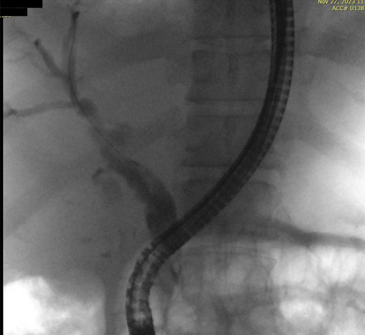 https://cdn.ncbi.nlm.nih.gov/pmc/blobs/0d40/11152821/9af3fa115b8a/ms9-86-3646-g003.jpg