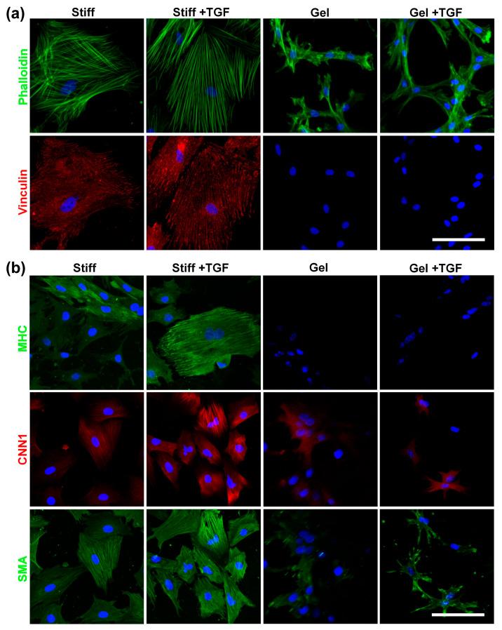 https://cdn.ncbi.nlm.nih.gov/pmc/blobs/0d44/12025518/e604581361d9/cells-14-00611-g007.jpg
