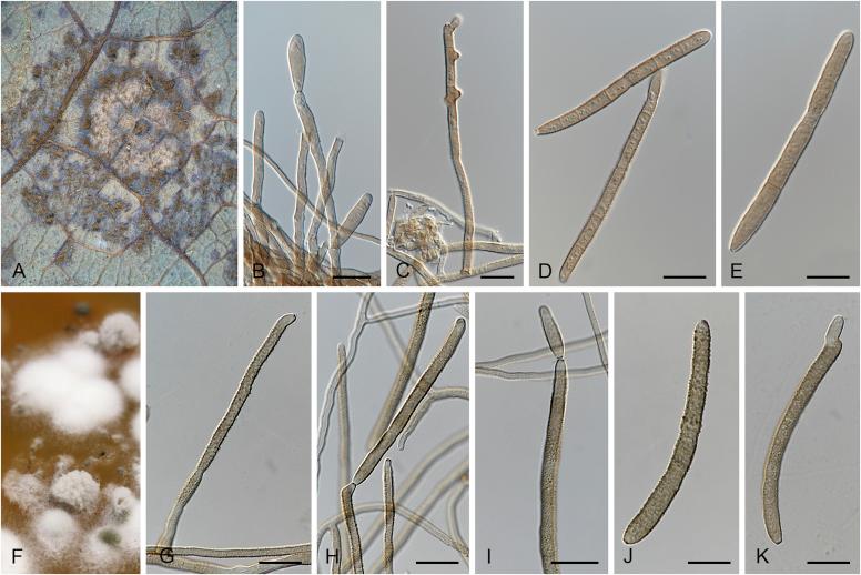 https://cdn.ncbi.nlm.nih.gov/pmc/blobs/0d4c/5693839/0a517122c7e2/gr43.jpg