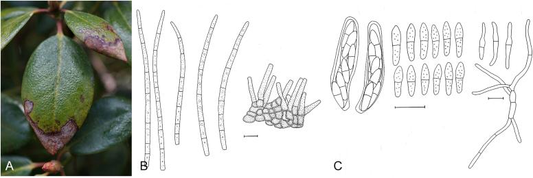 https://cdn.ncbi.nlm.nih.gov/pmc/blobs/0d4c/5693839/39698bf78889/gr46.jpg