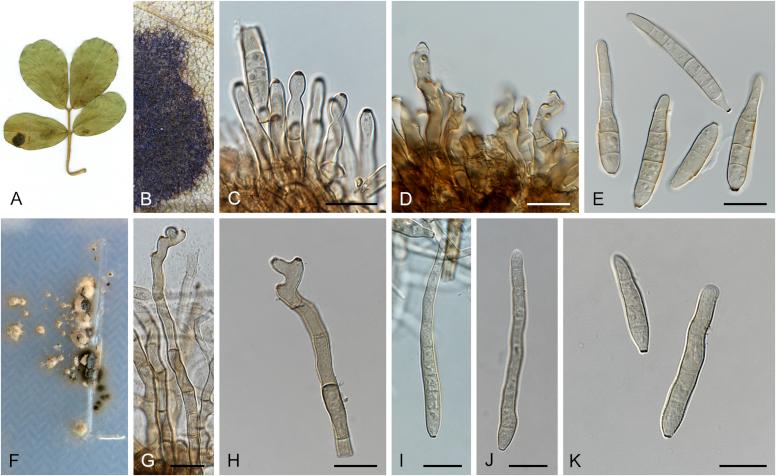 https://cdn.ncbi.nlm.nih.gov/pmc/blobs/0d4c/5693839/473812d0d7c6/gr26.jpg