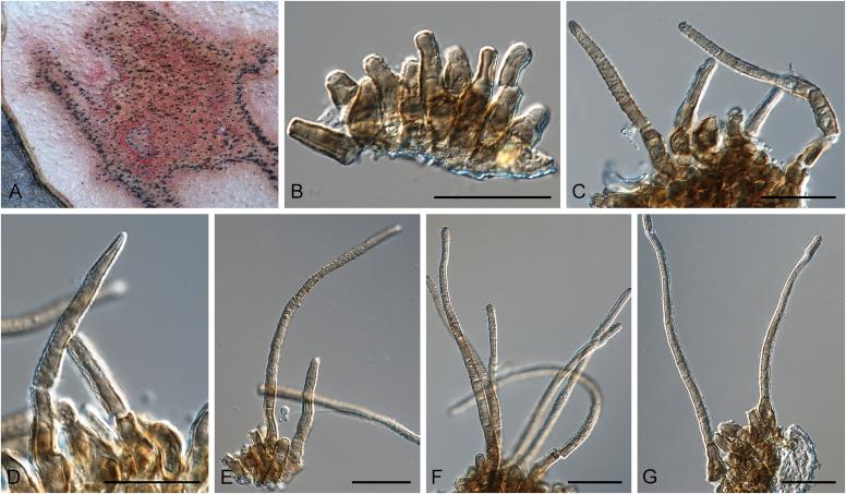 https://cdn.ncbi.nlm.nih.gov/pmc/blobs/0d4c/5693839/496a85175250/gr66.jpg