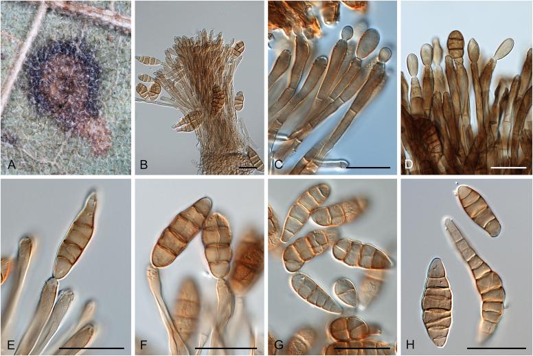 https://cdn.ncbi.nlm.nih.gov/pmc/blobs/0d4c/5693839/654a251789ee/gr25.jpg