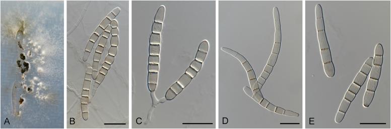 https://cdn.ncbi.nlm.nih.gov/pmc/blobs/0d4c/5693839/d80688594c87/gr29.jpg