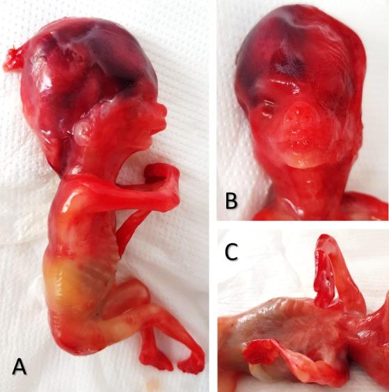 https://cdn.ncbi.nlm.nih.gov/pmc/blobs/0d51/6993769/76137127f9b6/CHSJ-45-3-333-fig5.jpg