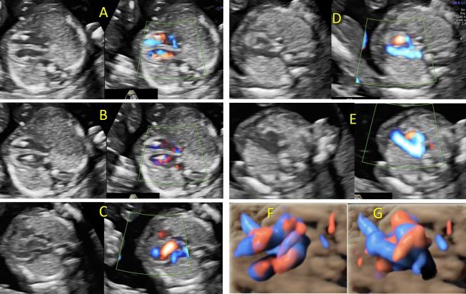 https://cdn.ncbi.nlm.nih.gov/pmc/blobs/0d51/6993769/8e6c43c90eb3/CHSJ-45-3-333-fig4.jpg
