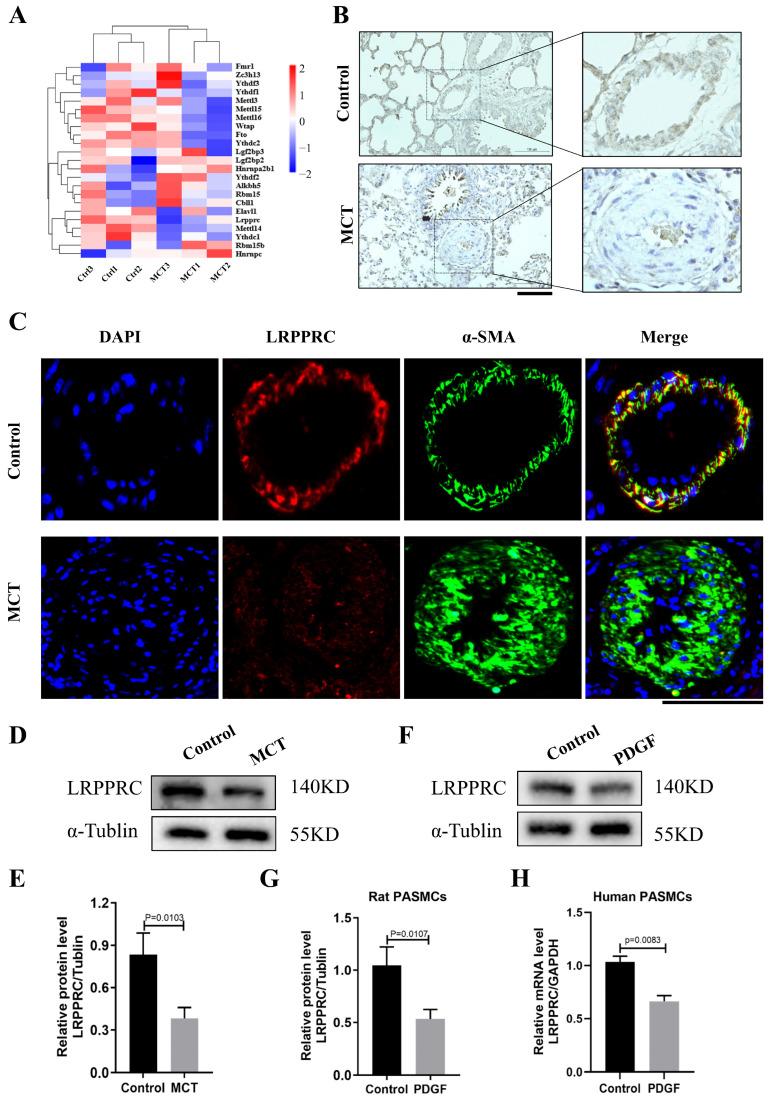 https://cdn.ncbi.nlm.nih.gov/pmc/blobs/0d59/10886831/a981d383cfe4/biomedicines-12-00364-g005.jpg