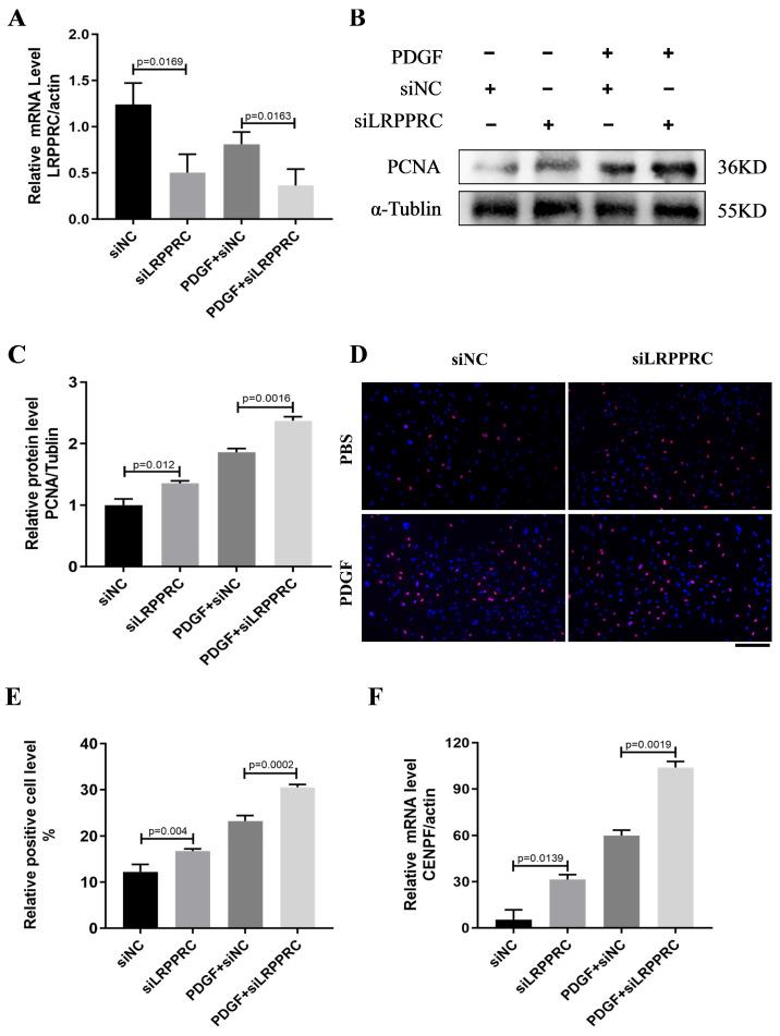 https://cdn.ncbi.nlm.nih.gov/pmc/blobs/0d59/10886831/e3c558bbbae9/biomedicines-12-00364-g006.jpg