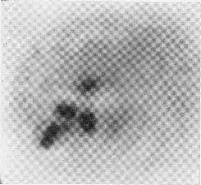 https://cdn.ncbi.nlm.nih.gov/pmc/blobs/0d5d/473616/374019516110/jclinpath00371-0043-i.jpg