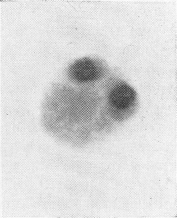 https://cdn.ncbi.nlm.nih.gov/pmc/blobs/0d5d/473616/3c641c0f4c3e/jclinpath00371-0043-h.jpg