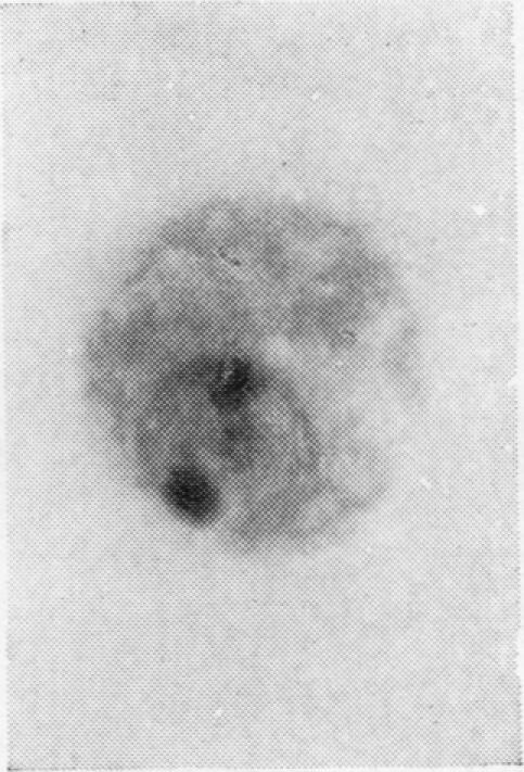 https://cdn.ncbi.nlm.nih.gov/pmc/blobs/0d5d/473616/bf204ddc20ad/jclinpath00371-0043-b.jpg