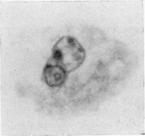 https://cdn.ncbi.nlm.nih.gov/pmc/blobs/0d5d/473616/c76f3845858e/jclinpath00371-0043-a.jpg