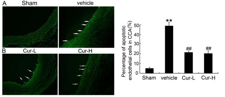 https://cdn.ncbi.nlm.nih.gov/pmc/blobs/0d63/4678154/30819a132037/IJMM-36-06-1563-g07.jpg