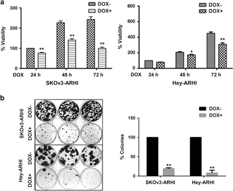 https://cdn.ncbi.nlm.nih.gov/pmc/blobs/0d68/4558501/f2144b886cb9/cddis2015208f1.jpg