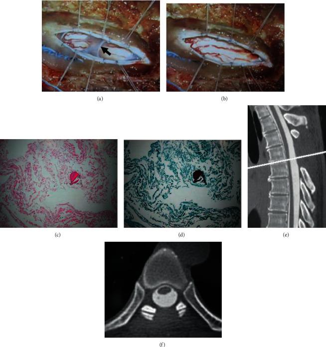 https://cdn.ncbi.nlm.nih.gov/pmc/blobs/0d68/7509563/c3c80784816a/CRIOR2020-8816598.004.jpg