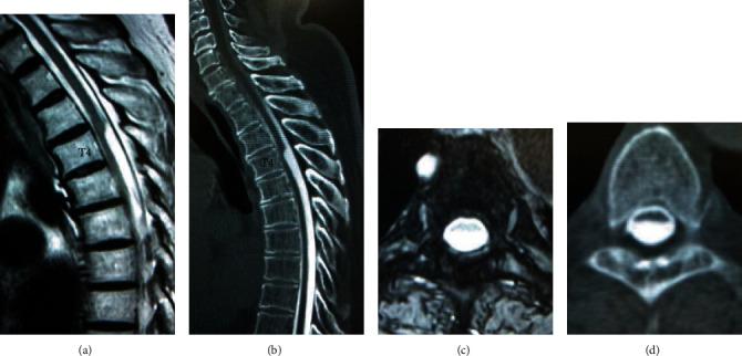 https://cdn.ncbi.nlm.nih.gov/pmc/blobs/0d68/7509563/e00b08218b80/CRIOR2020-8816598.001.jpg