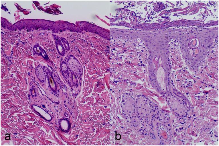 https://cdn.ncbi.nlm.nih.gov/pmc/blobs/0d69/5362004/14f8d91e3c1d/10.1177_2055116915621582-fig4.jpg
