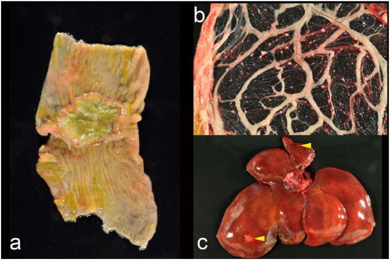 https://cdn.ncbi.nlm.nih.gov/pmc/blobs/0d69/5362004/cd7d31835cfd/10.1177_2055116915621582-fig3.jpg