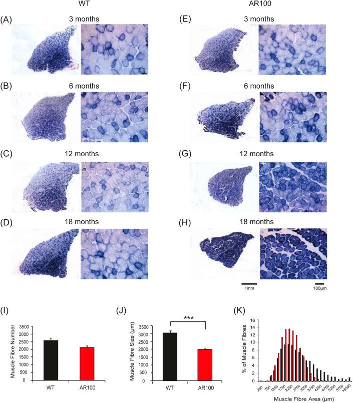 https://cdn.ncbi.nlm.nih.gov/pmc/blobs/0d69/7272358/0987cfb84b77/dmm-13-042424-g4.jpg
