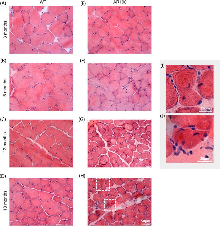 https://cdn.ncbi.nlm.nih.gov/pmc/blobs/0d69/7272358/5e187cd08f8d/dmm-13-042424-g5.jpg
