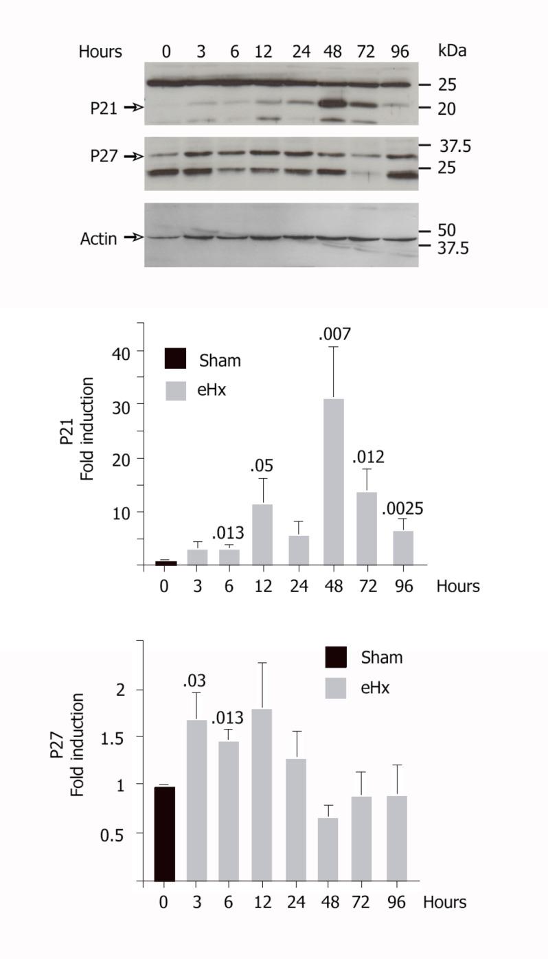 https://cdn.ncbi.nlm.nih.gov/pmc/blobs/0d75/7772727/f404c2ff384c/WJH-12-1198-g005.jpg
