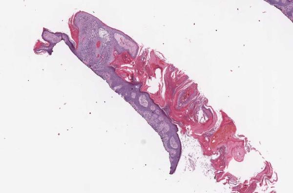 https://cdn.ncbi.nlm.nih.gov/pmc/blobs/0d77/1525169/da0a18fe52de/1472-6890-6-4-5.jpg