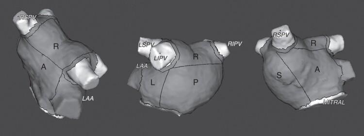 https://cdn.ncbi.nlm.nih.gov/pmc/blobs/0d7a/10644200/06ebe02824f7/euad246f3.jpg