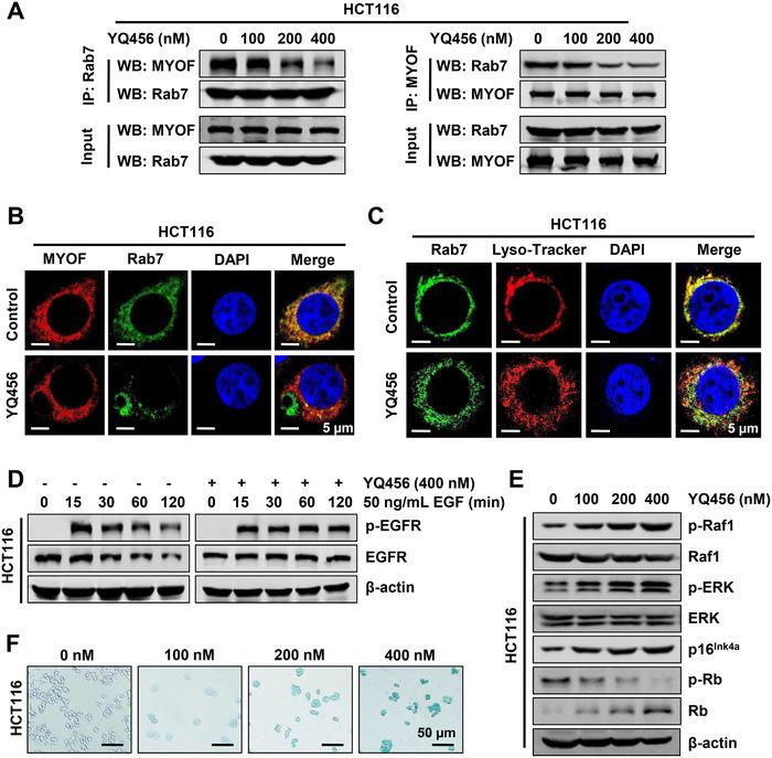 https://cdn.ncbi.nlm.nih.gov/pmc/blobs/0d7a/7868085/35ae5a2dee69/CTM2-11-e289-g006.jpg