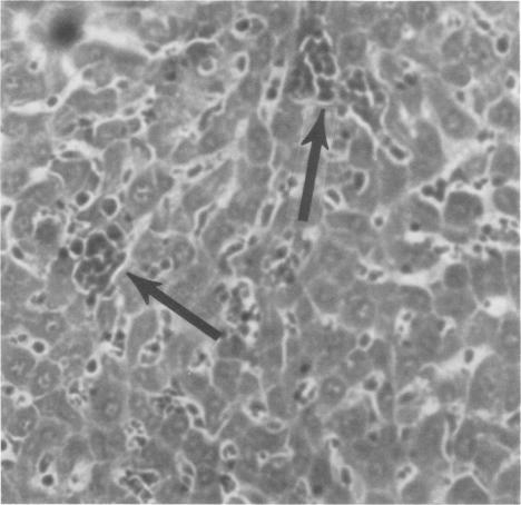 https://cdn.ncbi.nlm.nih.gov/pmc/blobs/0d7c/420783/6ca3f6ac2f37/iai00221-0176-a.jpg