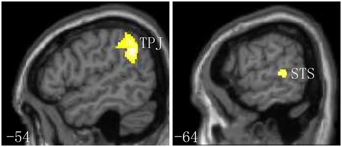 https://cdn.ncbi.nlm.nih.gov/pmc/blobs/0d7d/5462779/8be46a39eedc/41598_2017_3104_Fig3_HTML.jpg