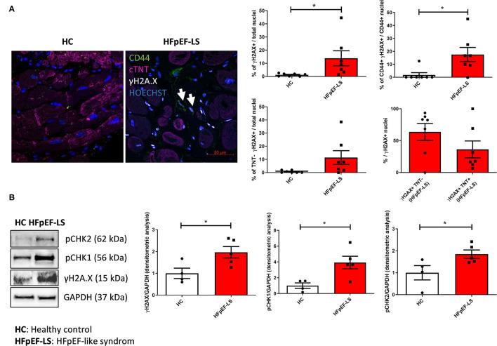 https://cdn.ncbi.nlm.nih.gov/pmc/blobs/0d7d/9259931/65967dfa1ad9/fcvm-09-878268-g0001.jpg